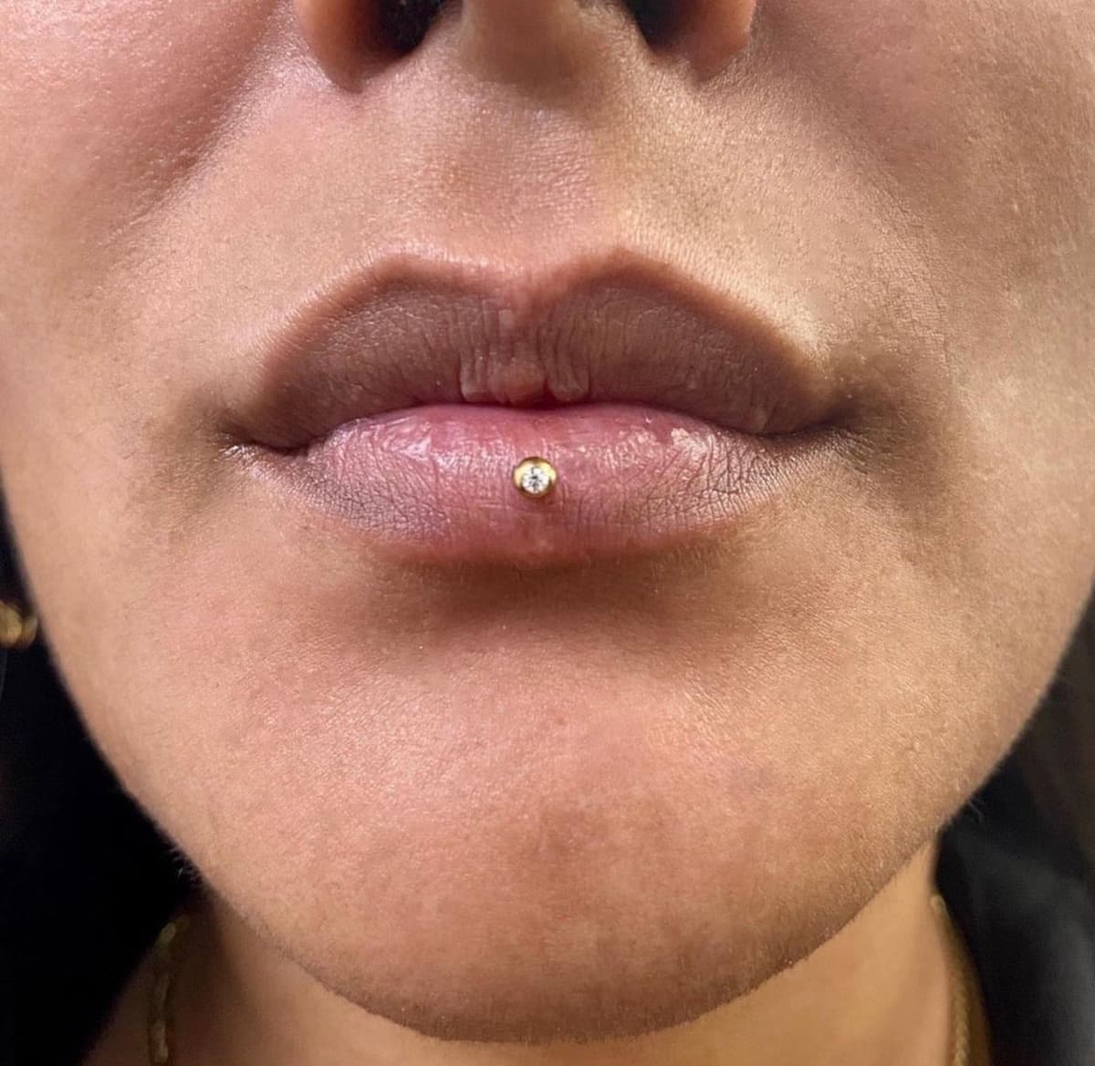 Frowny: Lower Frenulum