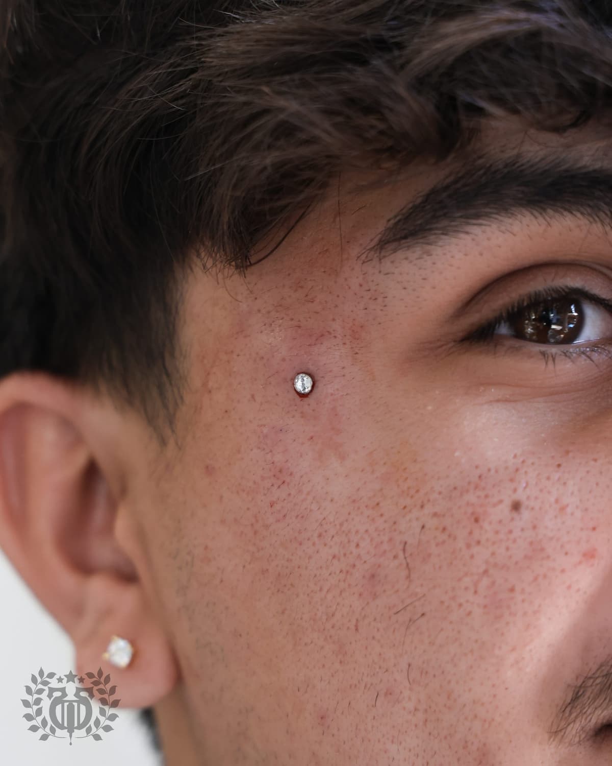 Cheekbone dermal anchor CZ close-up near eye on male client at Apollo Studio Los Angeles