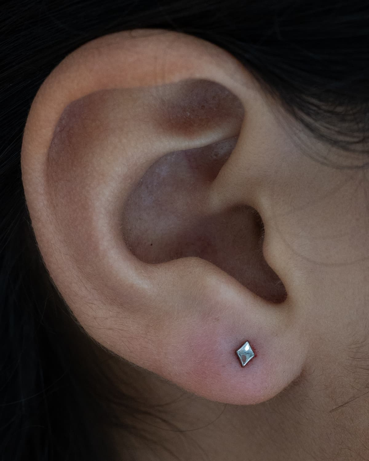 One Lobe, the Usual Starting Point
