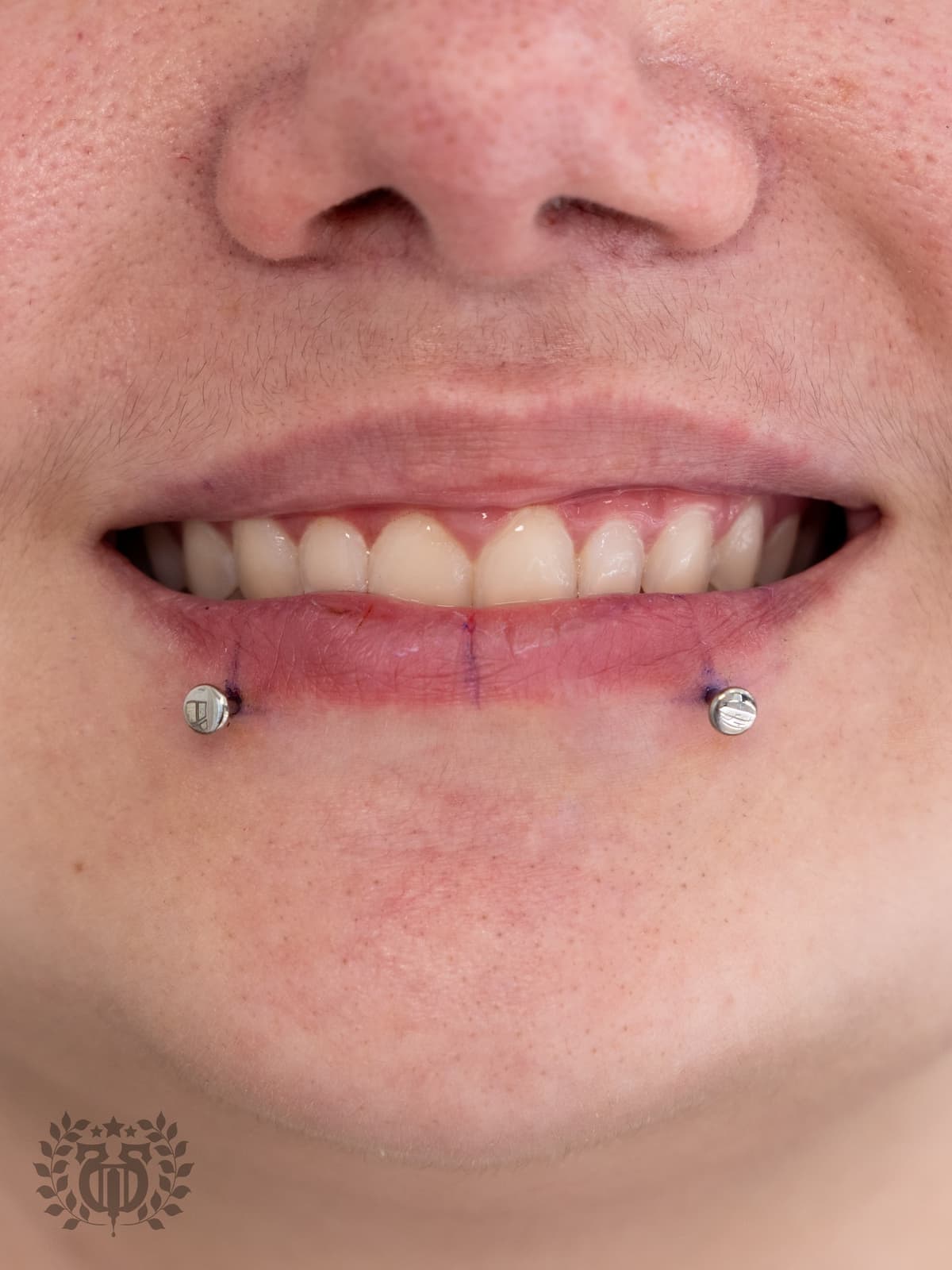 Side labret piercing with gold CZ bezel stud close-up at Apollo Tattoo and Piercing LA